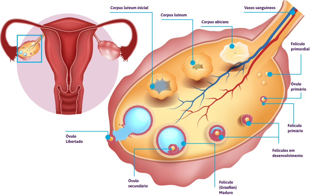 Ooforite autoimune: quando a imunidade pode atacar os ovarios