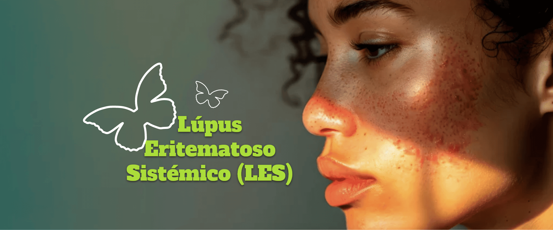 Banner-mobile